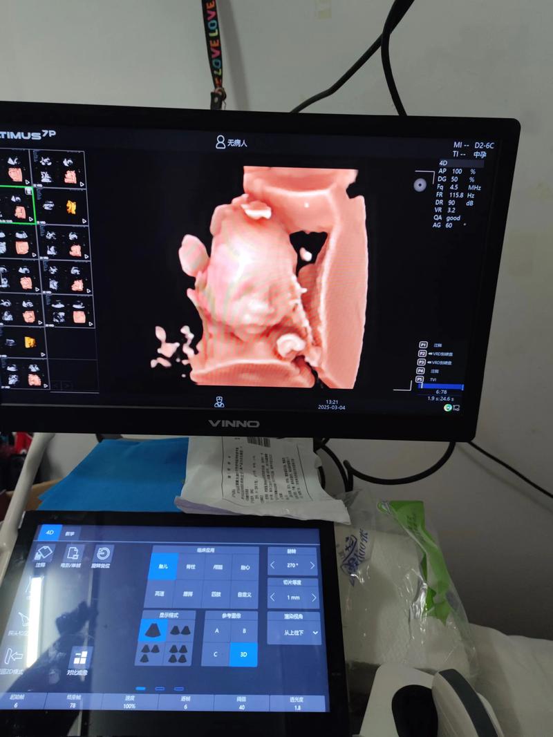 四维图新：2026年进入规模化量产的订单持续增加中