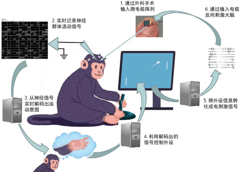 脑机接口技术临床应用提速，多位专家解码实施路径