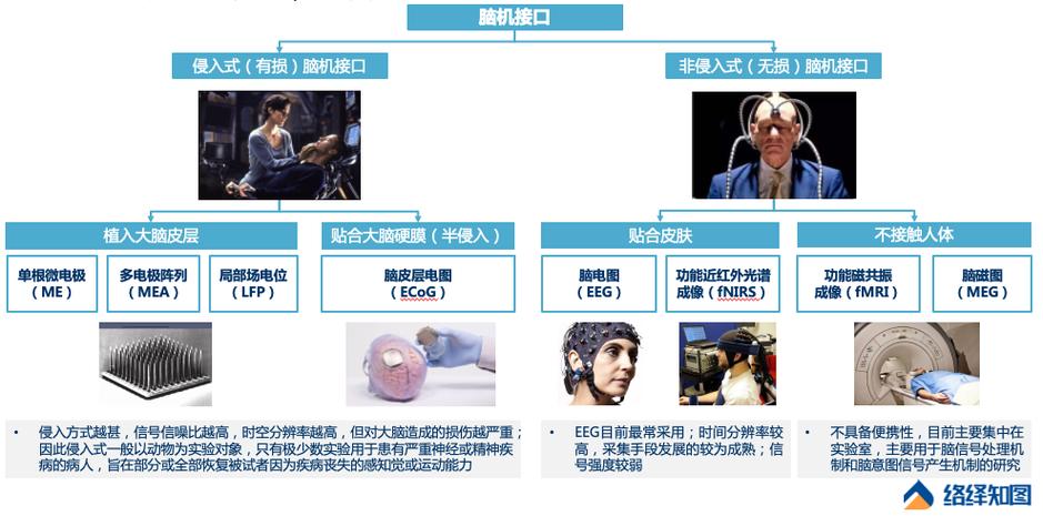 脑机接口技术临床应用提速,多位专家解码实施路径